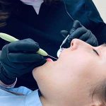 Root canal treatment in Bowenpally, Hyderabad